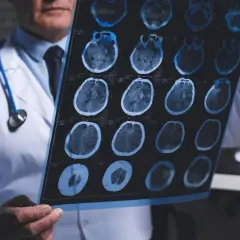 Neurolog od czego zacząć? Objawy, które mogą zaskoczyć