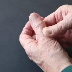 Dłoń wykonuje test Finkelsteina, sprawdzając ból w nadgarstku.
