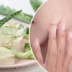 Jak zrobić aloes do nacierania? Świeże liście aloesu pokrojone w plastry i żel nałożony na twarz.