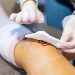 Opatrunek na ranie po operacji. Witamina C, witamina odpowiadająca za gojenie się ran, jest kluczowa dla regeneracji skóry.