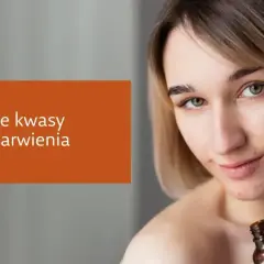 Młoda kobieta aplikuje serum z pipetki na twarz, by zwalczyć przebarwienia. Najlepsze kwasy na przebarwienia to klucz do gładkiej cery.