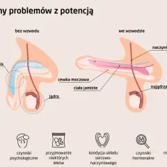 Ilustracja pokazuje budowę penisa bez i we wzwodzie, wyjaśniając przyczyny impotencji. Wymieniono nałogi, czynniki psychologiczne i inne.