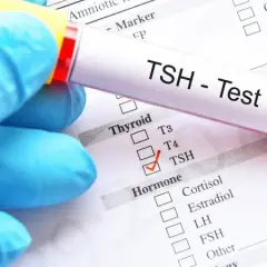 Badanie TSH: Co musisz wiedzieć o zdrowiu tarczycy?