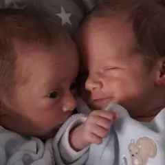 Dwa noworodki wtulone w siebie. Jeden z nich ma otwarte oczy, drugi lekko przymknięte. Ich twarze są blisko siebie, tworząc obraz bliskości. Zespół Patau to poważna choroba genetyczna, ale te dzieci wyglądają na zdrowe i kochane.