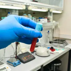 Ręka w niebieskiej rękawiczce trzyma probówkę z krwią. W tle laboratorium, gdzie badane są bazofile podwyższone u dziecka.