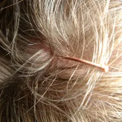 Nahaufnahme einer juckenden Kopfhaut mit feinen Haaren. Ein dünner, kupferfarbener Gegenstand, vielleicht ein Werkzeug für juckende Kopfhaut Hausmittel, liegt auf den Haaren.