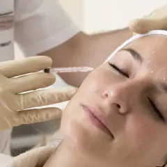 Zabieg z użyciem botoksu: precyzyjne botox miejsca wstrzyknięć na czole i skroniach.