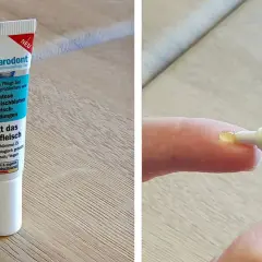 Parodont Zahnfleischpflege-Gel: eine mögliche beste Salbe gegen Zahnfleischentzündung, mit Schwarzkümmelöl.