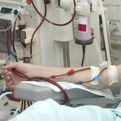 Ramię pacjenta podłączone do aparatury do dializy. Czerwone wężyki prowadzą krew do i z maszyny.