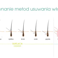 Elektroepilacja: Jedyna trwała depilacja dla każdego włosa?