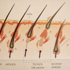 Cykl wzrostu włosa: anagen, katagen, telogen (10% włosów wypada dziennie), wczesny anagen.