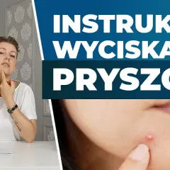 Jak szybko wysuszyć pryszcza? Ekspert radzi: dom i apteka