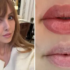Kvinna med ljus hy och brunt hår. Närbild på läppar före och efter lip blush-behandling.