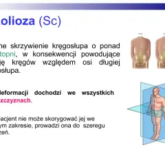 Skolioza (Sc) to boczne skrzywienie kręgosłupa. Test rissera ocenia dojrzałość kostną, pomocną w prognozowaniu progresji skoliozy.