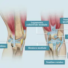 Anatomia del ginocchio con etichette: legamento collaterale mediale, menisco mediale, cavità poplitea, tendine del quadricipite, rotula, legamento collaterale laterale, menisco laterale, tendine rotuleo. Utile per chi soffre di gonalgia ginocchio sx.