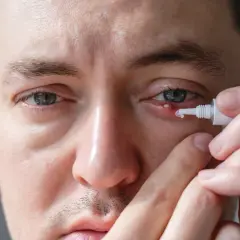 Mężczyzna aplikuje maść z detreomycyną na ropiejące oko.