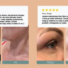 Pozytywne opinie o Oslo Skin Lab. Zdjęcia "przed" i "po" pokazują poprawę skóry. Kolagen idealny, wygodny w użyciu.