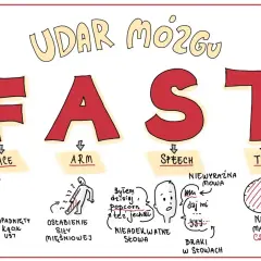 Objawy udaru mózgu: FAST. Asymetria twarzy, osłabienie siły mięśniowej, nieadekwatne słowa, braki w słowach, niewyraźna mowa, nie marnuj czasu. Czasownik to czynność, np. "daj mi".
