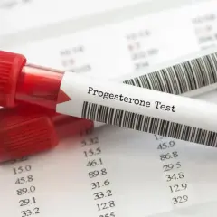 Dwie probówki z krwią oznaczone "Progesterone Test" leżą na papierze z wynikami badań. Kluczowe dla monitorowania progesteronu w ciąży.