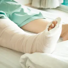 Noga w gipsie leży na szpitalnym łóżku. Palce stopy wystają z opatrunku, czekając na powrót do zdrowia.
