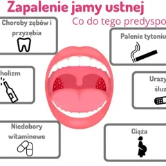 Ból w ustach? Zapalenie jamy ustnej objawy, rodzaje, pomoc