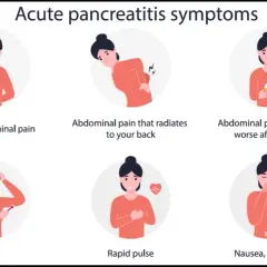 Síntomas pancreatitis leve: ¿Cómo reconocerlos y cuándo actuar?