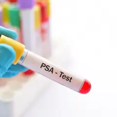 Ręka w niebieskiej rękawiczce trzyma probówkę z krwią do badania prostaty (PSA - Test). W tle widać inne probówki.