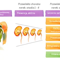 Czy po przeszczepie nerki należy się renta? Sprawdź ważne informacje
