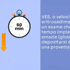 Provetta con globuli rossi e cronometro indicano un esame VES, utile per rilevare un'infezione ai denti o altre infiammazioni.