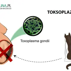 Toksoplazmoza a mózg: Objawy psychiczne, depresja i diagnostyka