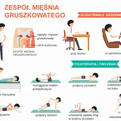 Ilustracja pokazuje zespół mięśnia gruszkowatego, jego objawy i ćwiczenia fizjoterapeutyczne, takie jak rozciąganie, podpory i pływanie.