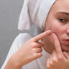 Pryszcze: Szybka pomoc, skuteczna pielęgnacja i zapobieganie