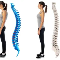 Postura scorretta e dolori addominali: confronto tra colonna vertebrale curva e dritta.
