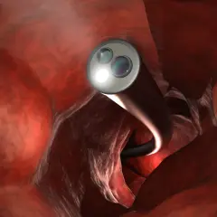 Endoskop leuchtet den Darm aus. Eine darmspiegelung neue methode ist weniger unangenehm dank moderner Technik.
