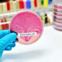 Ręka w niebieskiej rękawiczce trzyma szalkę Petriego z różową pożywką, na której widoczne są kolonie bakterii Escherichia coli.