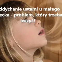 Dziecko z otwartymi ustami, sugerujące oddychanie przez usta. To problem, który wymaga uwagi i leczenia.