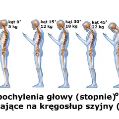 Schylanie się nad telefonem obciąża kręgosłup szyjny. Im większy kąt pochylenia głowy, tym większa siła działa na szyję.