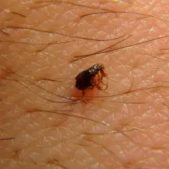 Una pulga, diminuta y oscura, se aferra a la piel humana, rodeada de finos vellos. Es como soñar con pulgas, una imagen que evoca picazón.