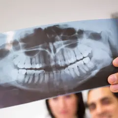 Lekarz analizuje panoramiczne badania radiograficzne szczęki, oceniając stan zębów i kości.