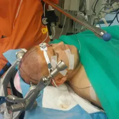 Pacjent przygotowany do operacji guza mózgu. Widoczny fragment głowy z zaznaczeniami i aparatura medyczna.