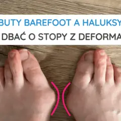 Jak zapobiec haluksom? Porady eksperta dla Twoich zdrowych stóp.
