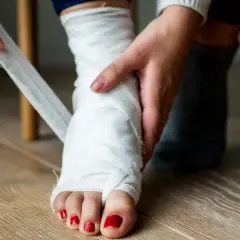 Osoba bandażuje stopę, co może być objawem skręconej kostki. Widoczne są palce z czerwonym lakierem.