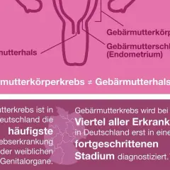 Symptome bei Gebärmutterkrebs: Warnzeichen, die Sie nicht ignorieren sollten