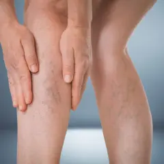 Czy lipofilling biustu się opłaca? Pełna analiza i porównanie