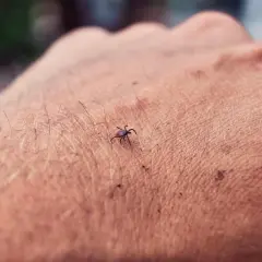 Kleszcz na skórze. Zastanawiasz się, po jakim czasie od ukąszenia kleszcza zrobić badanie na boreliozę?