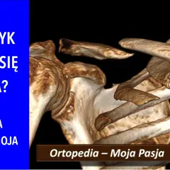 Trójwymiarowy obraz obojczyka, który pokazuje, ile zrasta się kość po urazie. "Ortopedia – Moja Pasja #064".