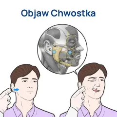 Tężyczka a nerwica: objawy psychiczne, diagnoza i leczenie