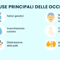 Cause delle occhiaie scure: genetica, invecchiamento, stress, cattiva circolazione, disidratazione e iperpigmentazione.