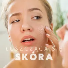 Kobieta z lekką łuszczycą na policzku dotyka swojej suchej, łuszczącej się skóry, patrząc w lustro.