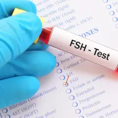 Rękawiczka w niebieskiej rękawiczce trzyma probówkę z napisem "FSH - Test". Obok zaznaczono opcję FSH na liście badań.
